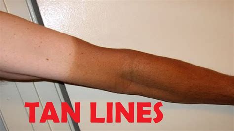 tanline nude pics