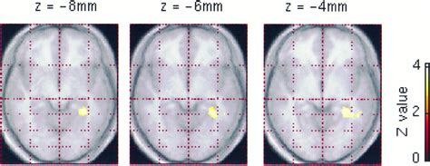Taxi Driver Brain Study