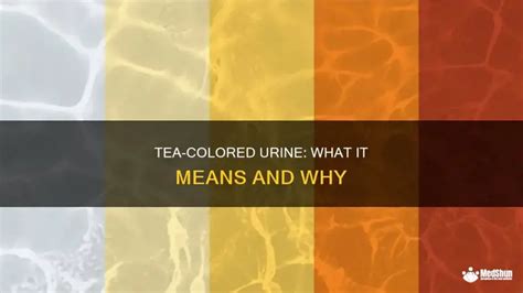 tea colored urine