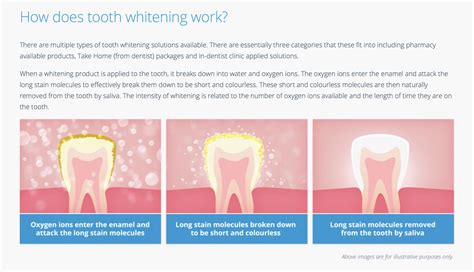 Teeth Whitening How It Works Types And Side White Science Teeth Whitening - White Science Teeth Whitening