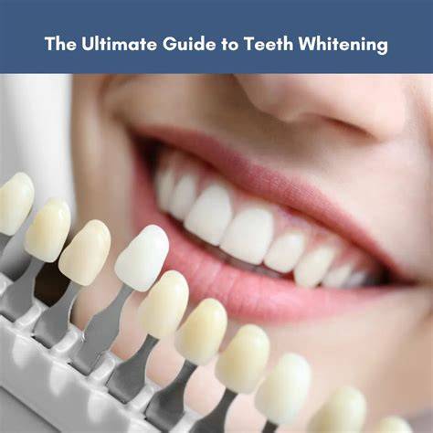 teeth whitening the ultimate guide to a healthier