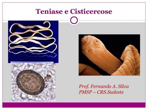 Teniase E Cisticercose