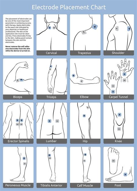 Tens Electrode Placement Chart Pdf