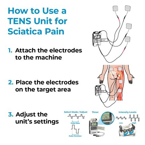 Tens Placement For Sciatica