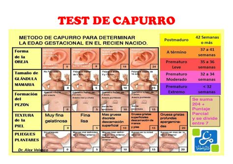 Test De Capurro