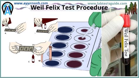 test procedure