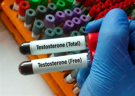 Test Tubes And Testosterone A Mans Journey Into Infertility And Ivf