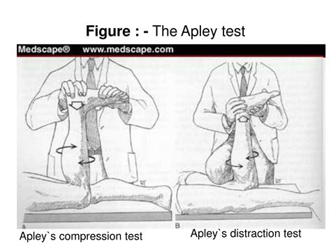 Teste De Apley