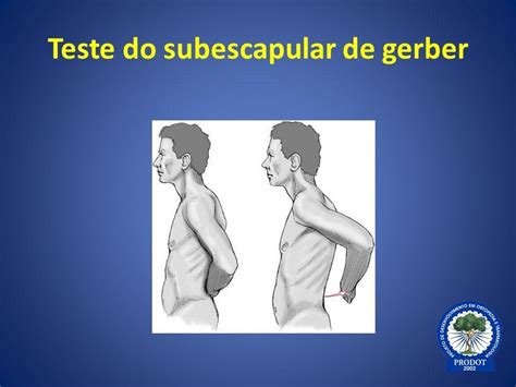 Teste De Gerber