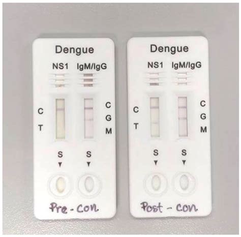 teste dengue