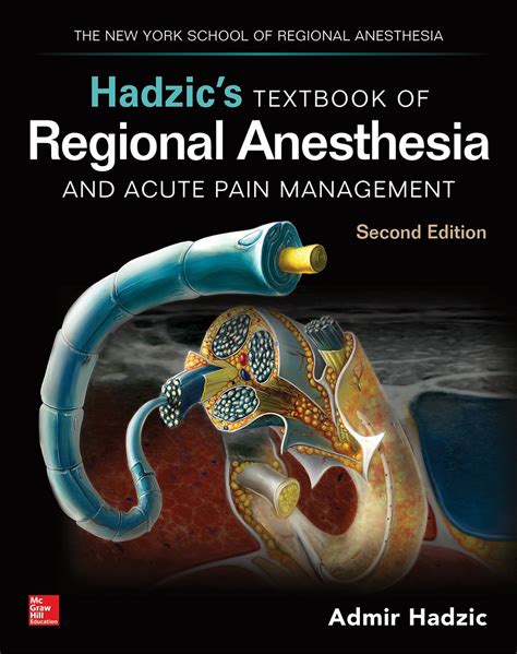 Full Download Textbook Of Regional Anesthesia And Acute Pain Management Hadzic Textbook Of Regional Anesthesia And Acute Pain Management 