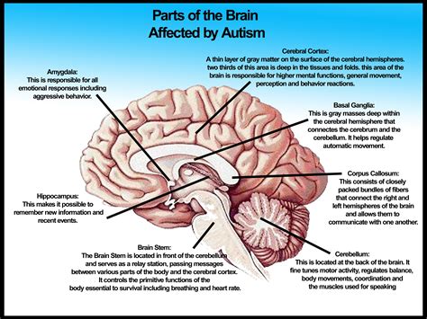 The Autistic Brain