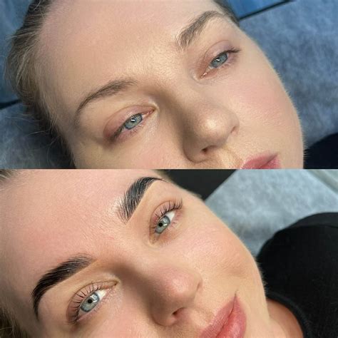 The Brow