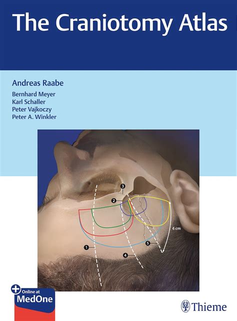 the craniotomy atlas