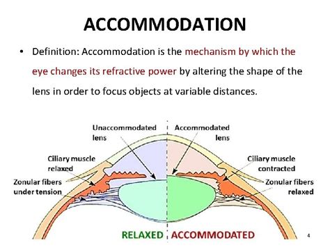 The Definition Of Accommodation