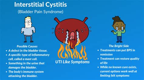 The Interstitial Cystitis Solution A Holistic Plan For Healing Painful Symptoms Resolving Bladder And Pelvic