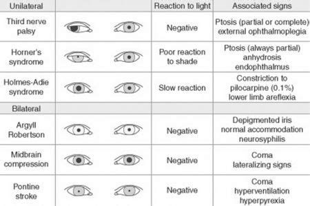 The Normal Grade Of Eyes Perrla Eyes Eyes Grade - Eyes Grade