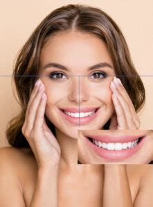 The Perfect Smile