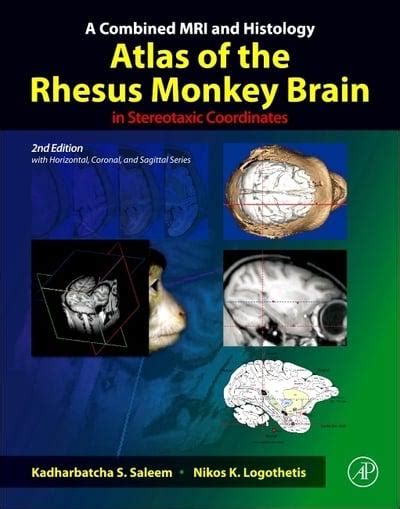 Read The Rhesus Monkey Brain In Stereotaxic Coordinates 2Nd Edition 