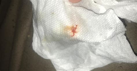 there is blood in my phlegm