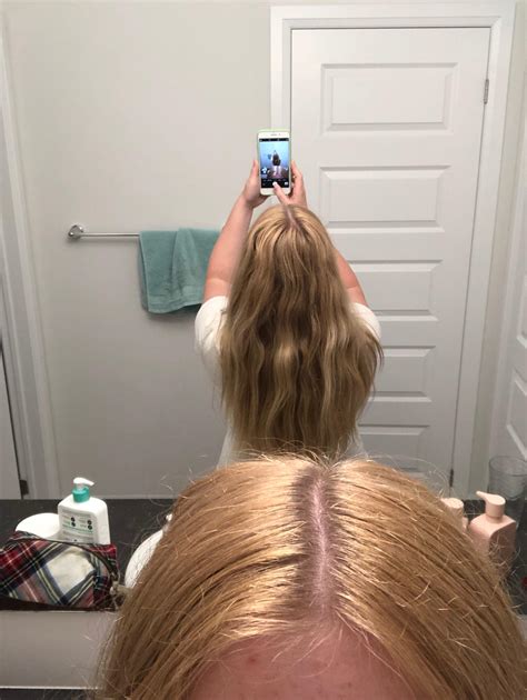 Thick Hair Reddit