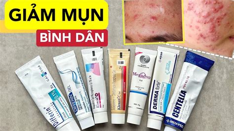 thuốc trị mụn | Thuc ung tr mn c nhng loi