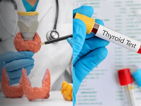 thyroid test brooksville florida