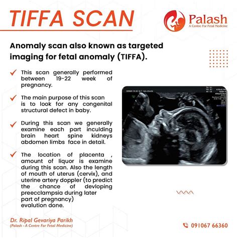 Tiffa Scan Means