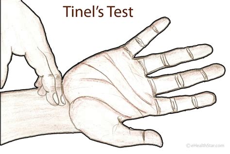 tinels sign test for ulnar nerve