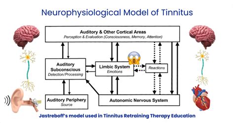 Tinnitus Retraining Therapy