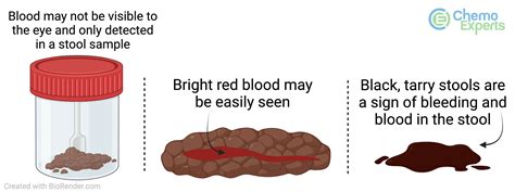 tiny blood in stool