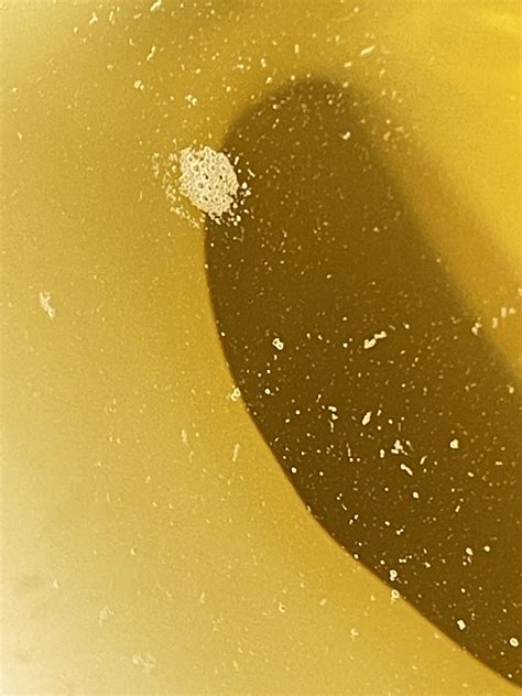 tiny bubbles in pee