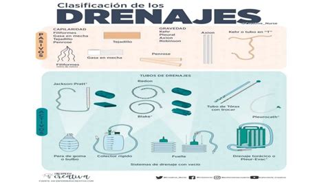 Tipos De Drenajes