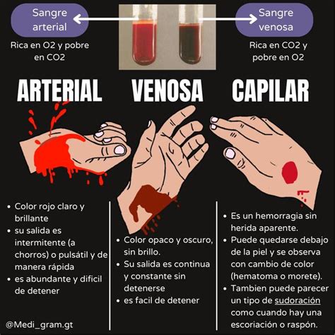 Tipos De Hemorragia