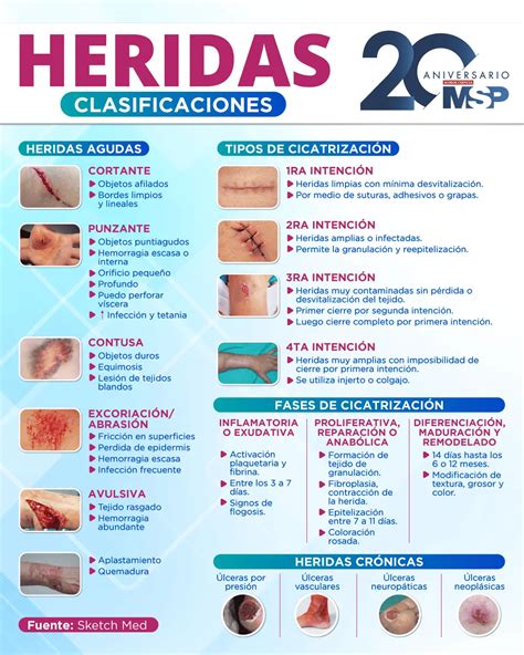 Tipos De Heridas
