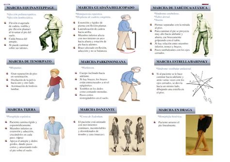 Tipos De Marcha