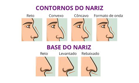 Tipos De Nariz