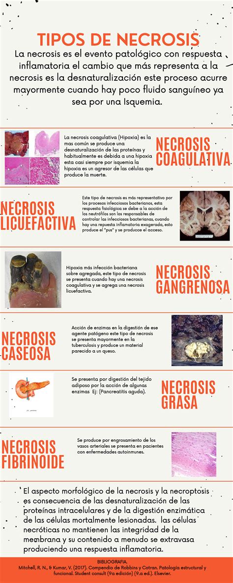 Tipos De Necrosis