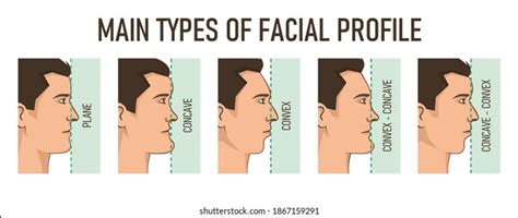 Tipos De Perfil Facial