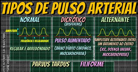 Tipos De Pulso