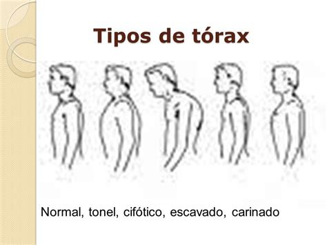 Tipos De Tórax