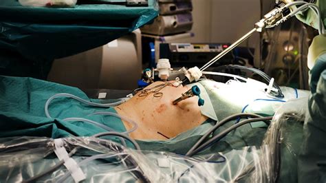 titthålsoperation prostatan