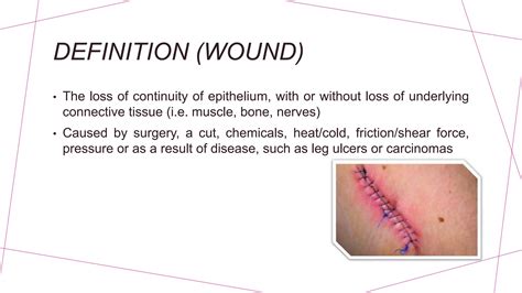 to wound definition
