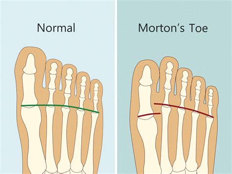Toe By Toe