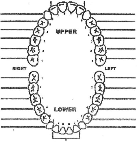 Mucinex DM, when taken as directed, can cause mil