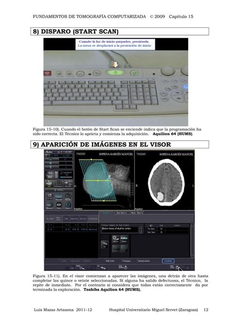 Download Toshiba Aquilion 8 Ct Scan User Guide 