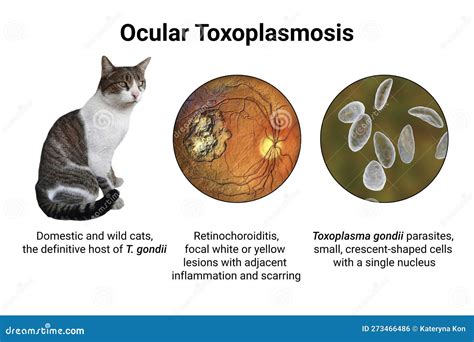 toxoplasmos symtom