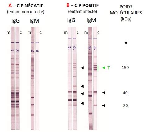 toxoplasmose uitslag
