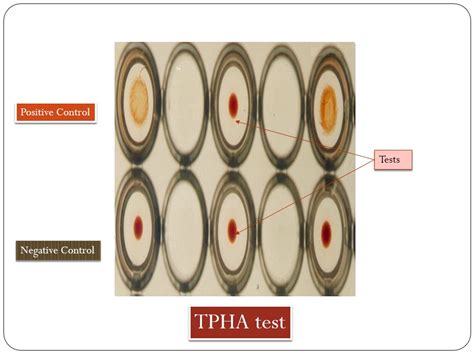 Tpha Test Full Form
