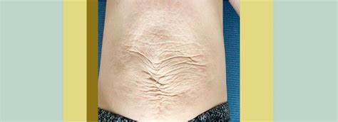 träning delade magmuskler